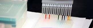 image of lab test where colorful substances are being injected into test tray