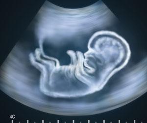 Ultrasound image of baby in womb