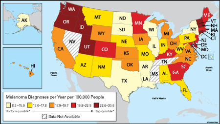 Skin Cancer Facts For Your State  Sun Safety  US EPA